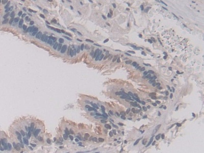 Polyclonal Antibody to Annexin A11 (ANXA11)