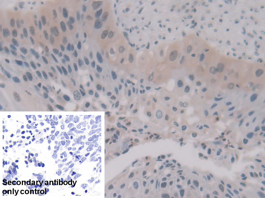 Polyclonal Antibody to Annexin A11 (ANXA11)