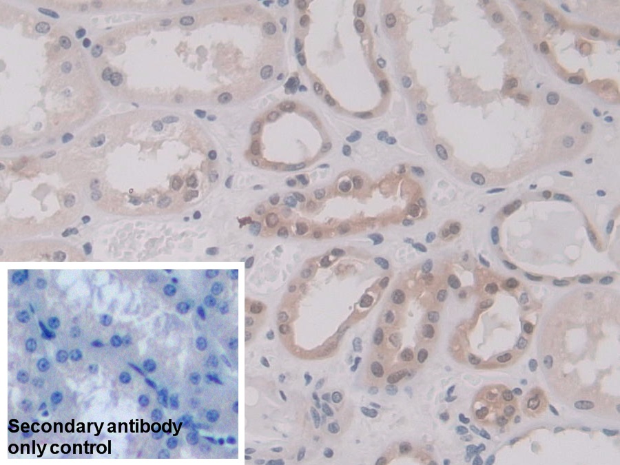 Polyclonal Antibody to Annexin A11 (ANXA11)