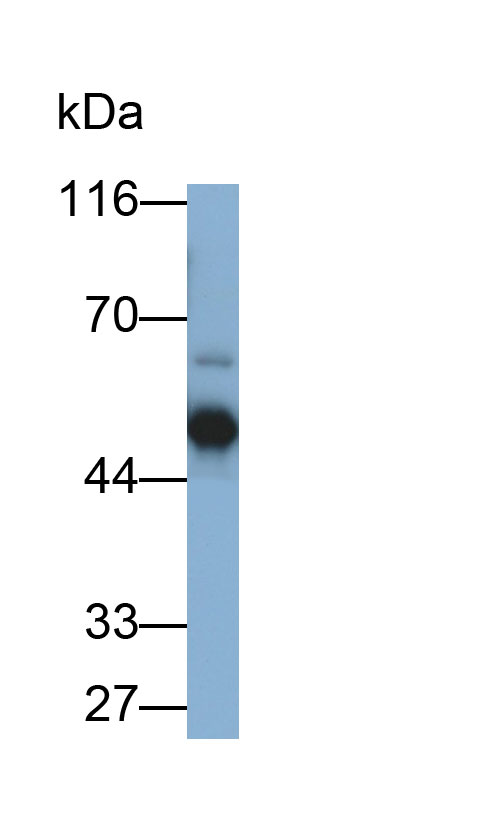 Polyclonal Antibody to Annexin A7 (ANXA7)