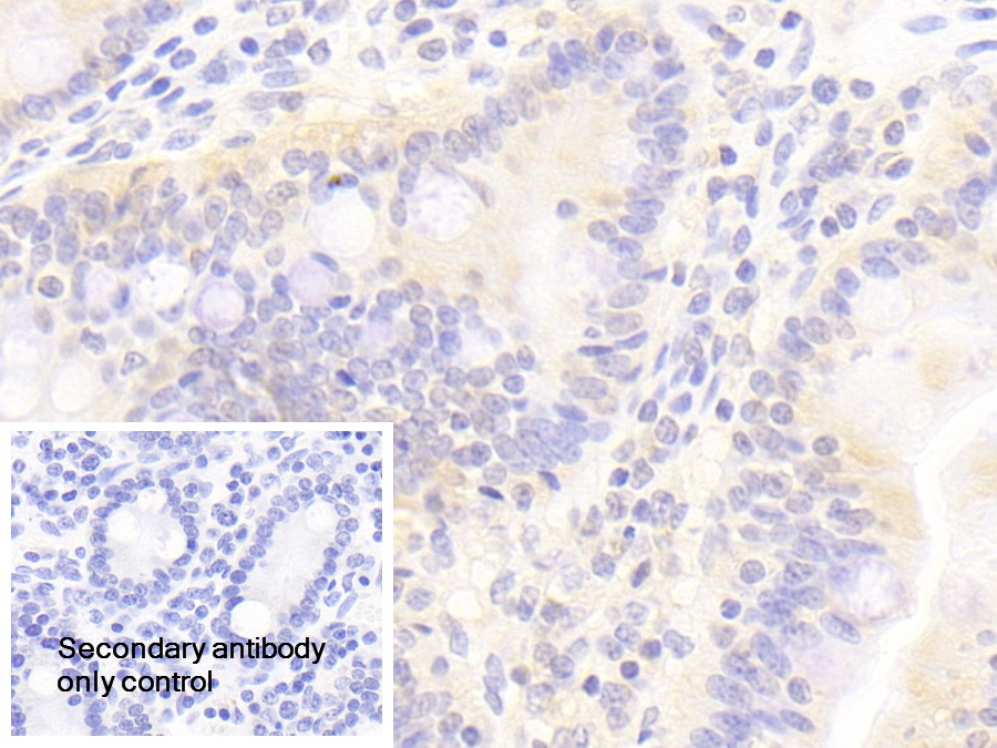 Polyclonal Antibody to Annexin A13 (ANXA13)