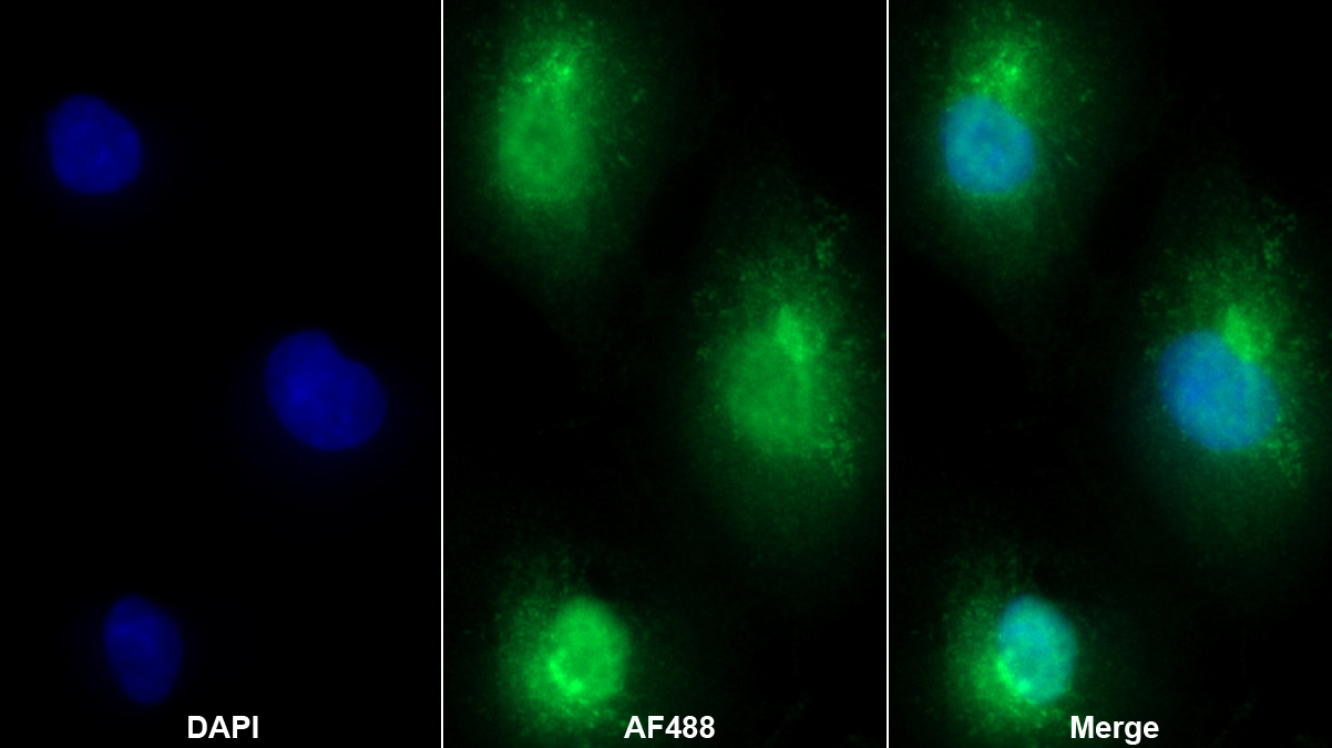 Polyclonal Antibody to Annexin A4 (ANXA4)