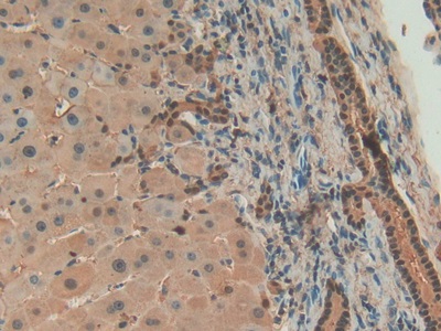 Polyclonal Antibody to Annexin A4 (ANXA4)