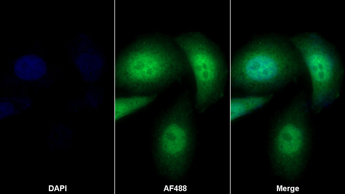 Polyclonal Antibody to Annexin A4 (ANXA4)