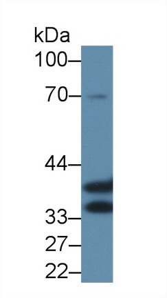 Polyclonal Antibody to Annexin A4 (ANXA4)