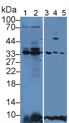 Polyclonal Antibody to Annexin A4 (ANXA4)