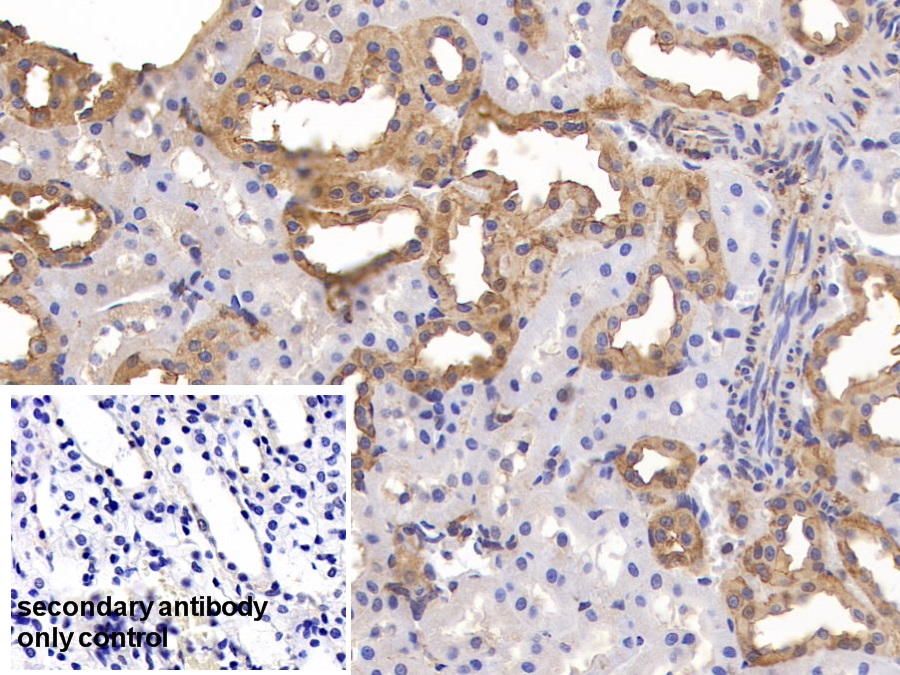 Polyclonal Antibody to Annexin A4 (ANXA4)