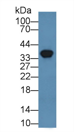 Polyclonal Antibody to Annexin A3 (ANXA3)