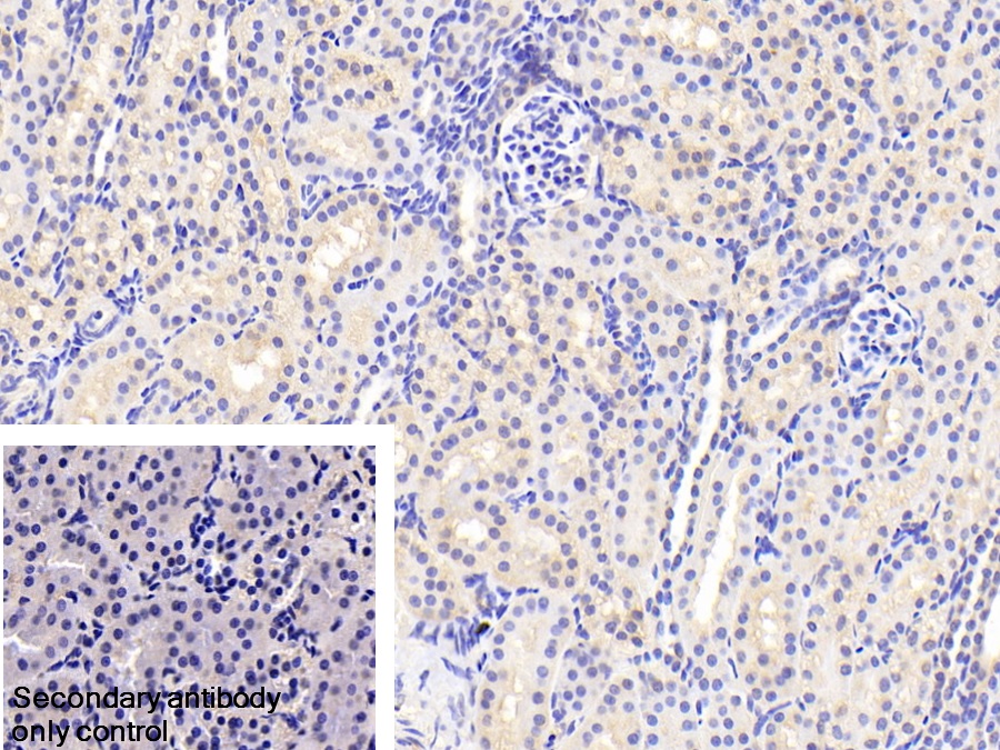 Polyclonal Antibody to Annexin A3 (ANXA3)