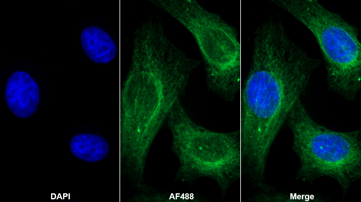 Polyclonal Antibody to Annexin A3 (ANXA3)