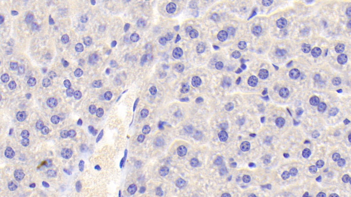 Polyclonal Antibody to Annexin A3 (ANXA3)