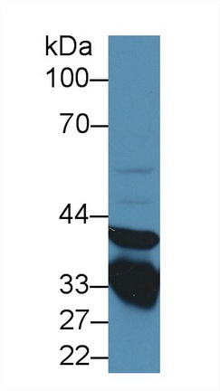 Polyclonal Antibody to Annexin A3 (ANXA3)