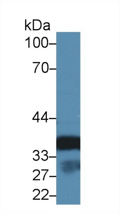 Polyclonal Antibody to Annexin A3 (ANXA3)