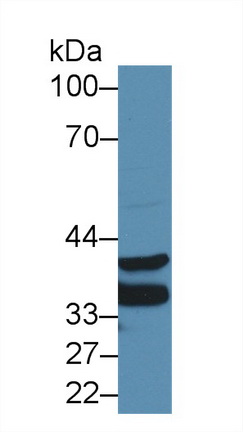 Polyclonal Antibody to Annexin A3 (ANXA3)