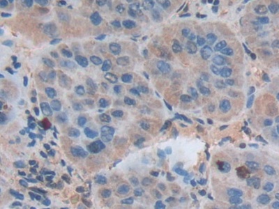 Polyclonal Antibody to Annexin A3 (ANXA3)