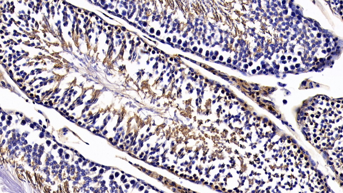 Polyclonal Antibody to Annexin A3 (ANXA3)