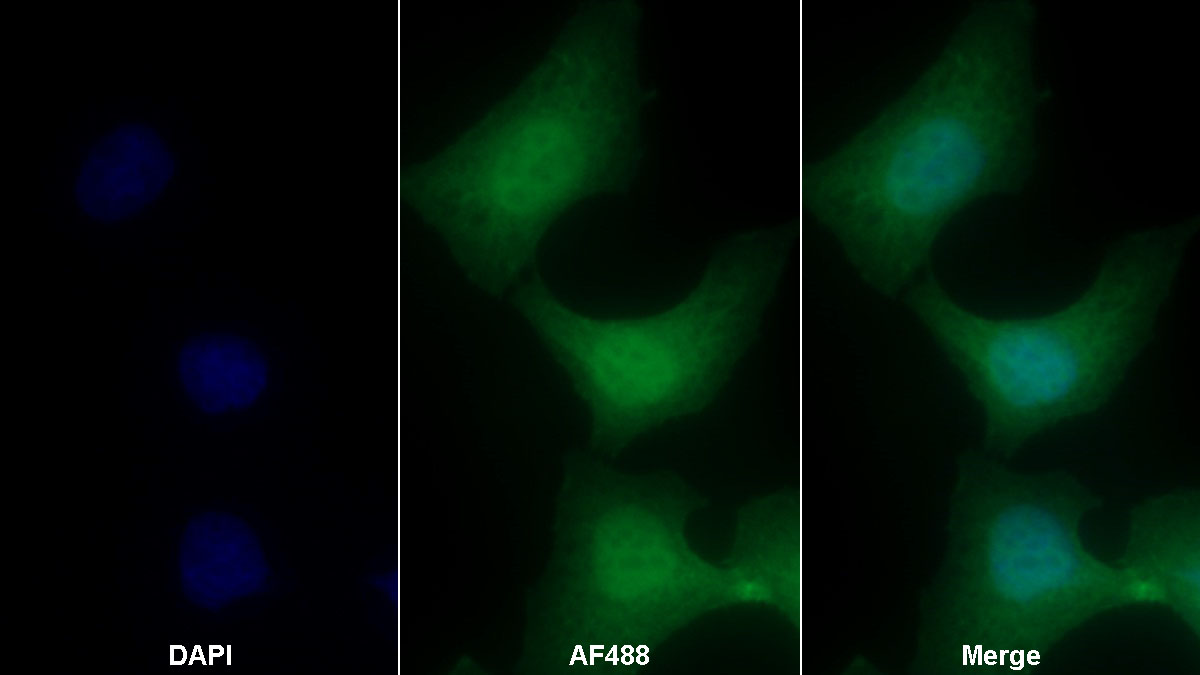 Polyclonal Antibody to Annexin A1 (ANXA1)