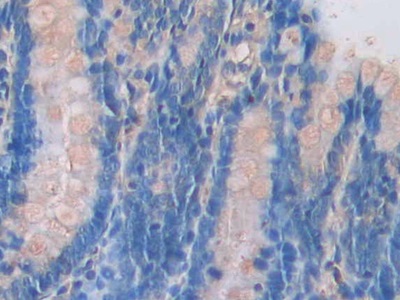 Polyclonal Antibody to Pannexin 1 (PANX1)