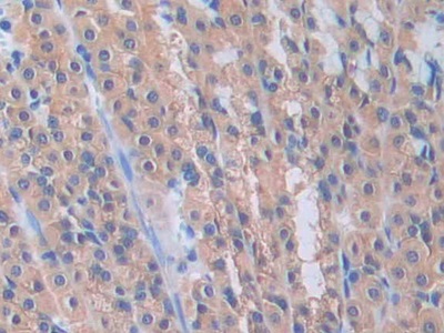 Polyclonal Antibody to Pannexin 1 (PANX1)