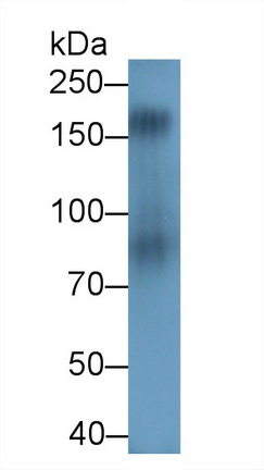 Polyclonal Antibody to Glutamate Receptor, Ionotropic, N-Methyl-D-Aspartate 2B (GRIN2B)