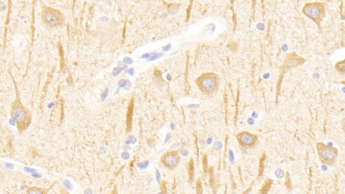 Polyclonal Antibody to Glutamate Receptor, Metabotropic 1 (GRM1)