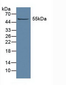 Polyclonal Antibody to Aldehyde Dehydrogenase 1 Family, Member A1 (ALDH1A1)