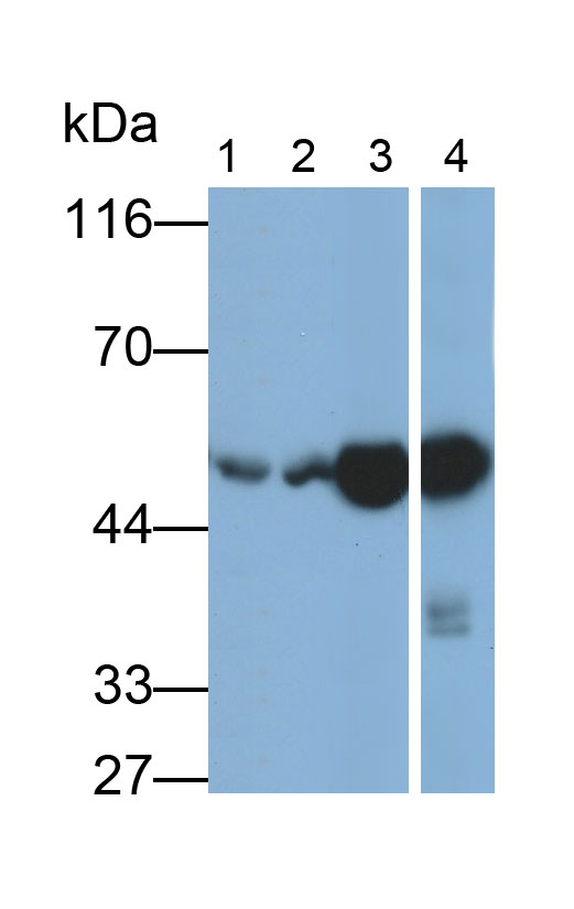 Polyclonal Antibody to Aldehyde Dehydrogenase 1 Family, Member A1 (ALDH1A1)