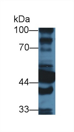 Polyclonal Antibody to Aldehyde Dehydrogenase 1 Family, Member A1 (ALDH1A1)