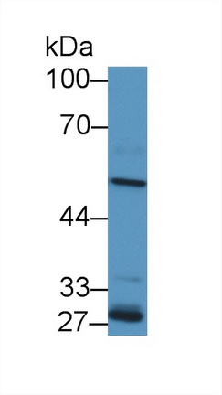 Polyclonal Antibody to Aldehyde Dehydrogenase 1 Family, Member A2 (ALDH1A2)