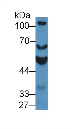 Polyclonal Antibody to Aldehyde Dehydrogenase 1 Family, Member A2 (ALDH1A2)