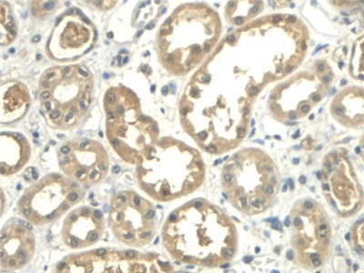 Polyclonal Antibody to Aldehyde Dehydrogenase 1 Family, Member A2 (ALDH1A2)