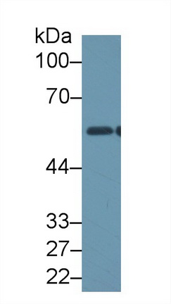 Polyclonal Antibody to Aldehyde Dehydrogenase 1 Family, Member B1 (ALDH1B1)