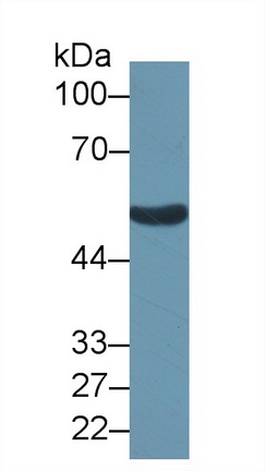 Polyclonal Antibody to Aldehyde Dehydrogenase 1 Family, Member B1 (ALDH1B1)