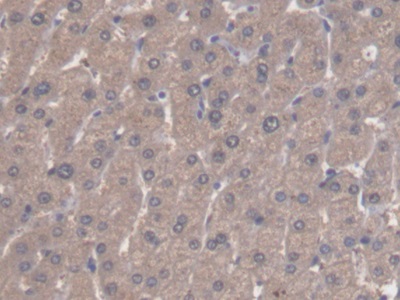 Polyclonal Antibody to Aldehyde Dehydrogenase 3 Family, Member A1 (ALDH3A1)