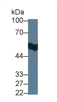 Polyclonal Antibody to Aldehyde Dehydrogenase 3 Family, Member A1 (ALDH3A1)