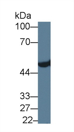 Polyclonal Antibody to Aldehyde Dehydrogenase 3 Family, Member A1 (ALDH3A1)