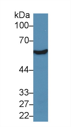 Polyclonal Antibody to Aldehyde Dehydrogenase 7 Family, Member A1 (ALDH7A1)