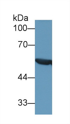 Polyclonal Antibody to Aldehyde Dehydrogenase 7 Family, Member A1 (ALDH7A1)