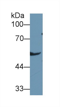 Polyclonal Antibody to Aldehyde Dehydrogenase 7 Family, Member A1 (ALDH7A1)