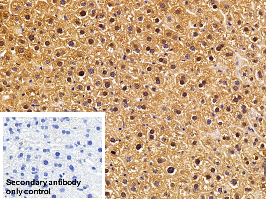 Polyclonal Antibody to Aldehyde Dehydrogenase 7 Family, Member A1 (ALDH7A1)