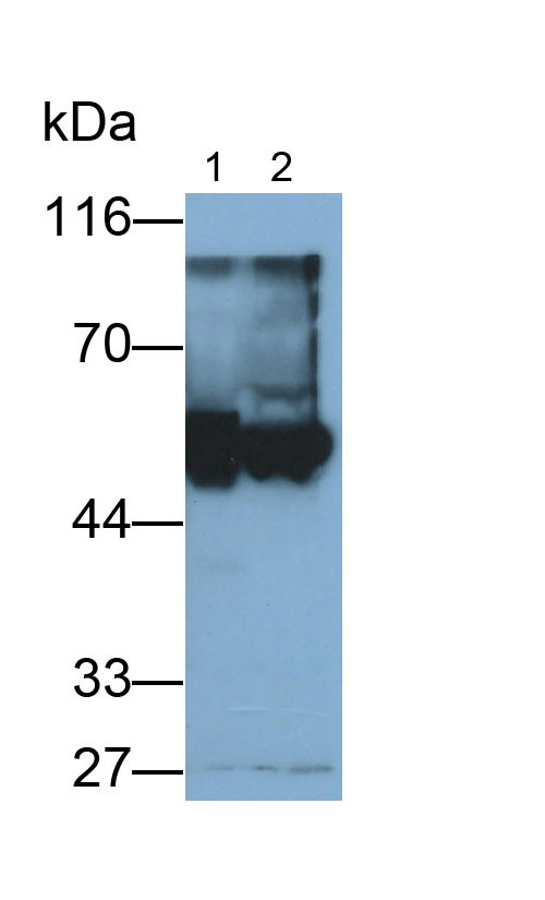 Polyclonal Antibody to Aldehyde Dehydrogenase 7 Family, Member A1 (ALDH7A1)