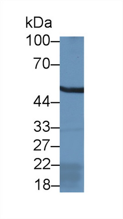 Polyclonal Antibody to Aldehyde Dehydrogenase 9 Family, Member A1 (ALDH9A1)