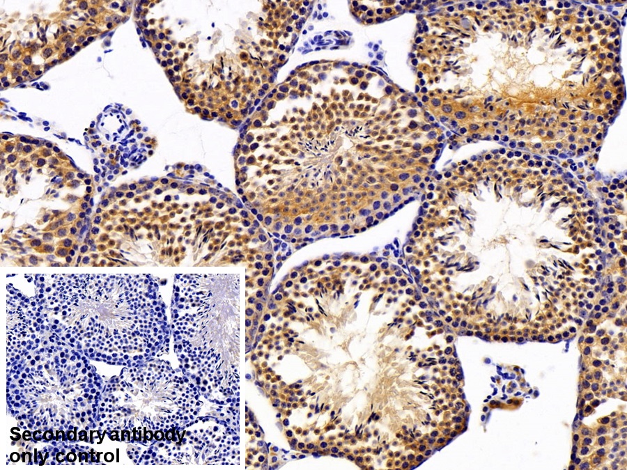 Polyclonal Antibody to Diacylglycerol Kinase Delta (DGKd)