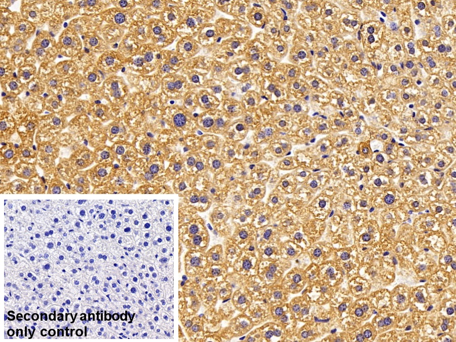 Polyclonal Antibody to Diacylglycerol Kinase Delta (DGKd)