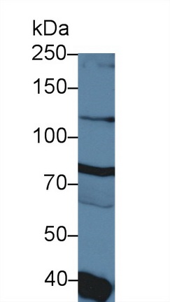 Polyclonal Antibody to Diacylglycerol Kinase Gamma (DGKg)