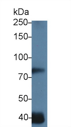 Polyclonal Antibody to Diacylglycerol Kinase Gamma (DGKg)