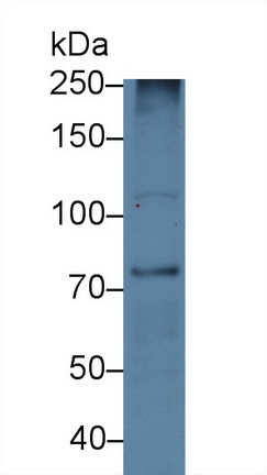 Polyclonal Antibody to Diacylglycerol Kinase Gamma (DGKg)