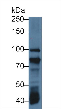 Polyclonal Antibody to Diacylglycerol Kinase Gamma (DGKg)