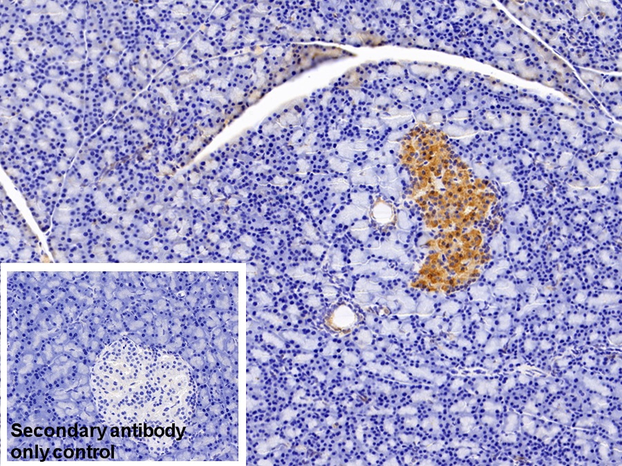 Polyclonal Antibody to Diacylglycerol Kinase Zeta (DGKz)