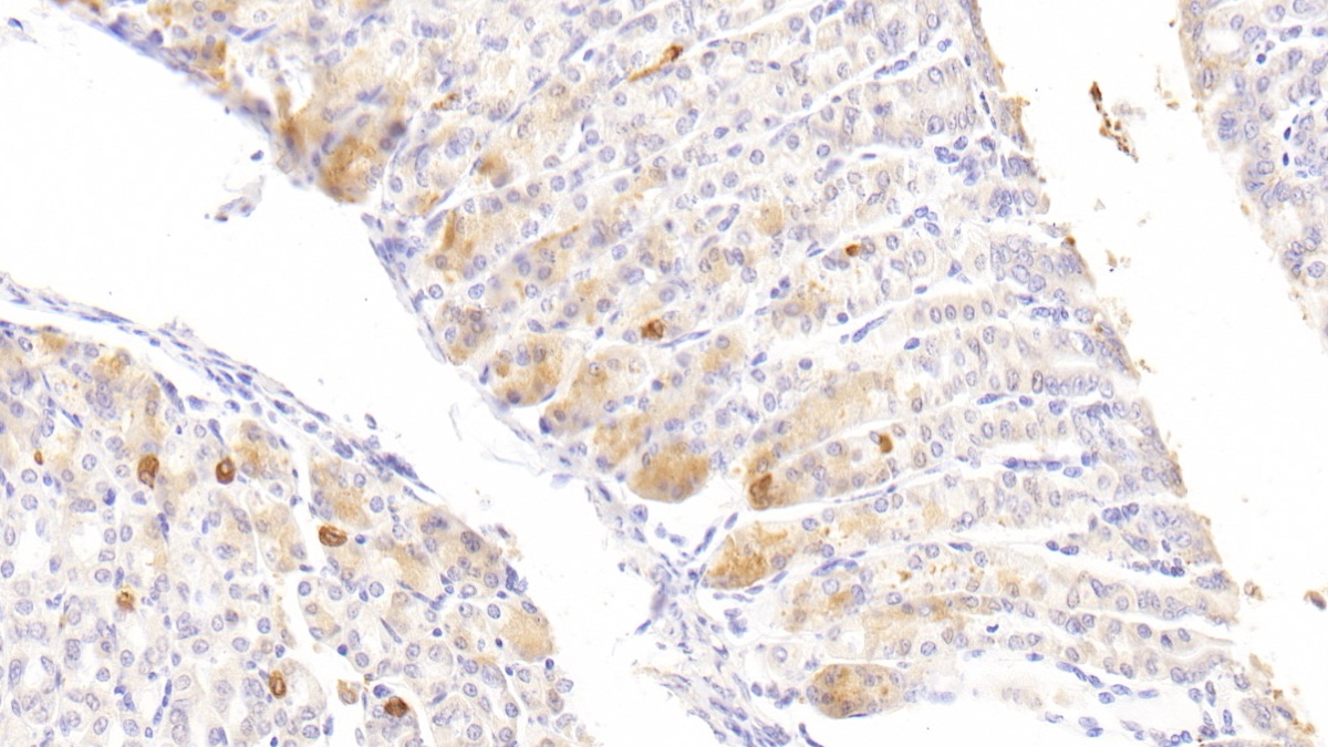 Polyclonal Antibody to Diacylglycerol Kinase Zeta (DGKz)